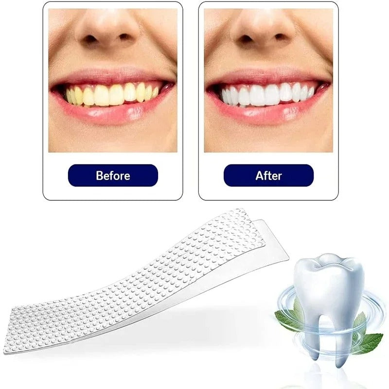 5D Teeth Whitening Strips